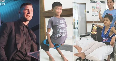 defying in tagalog|Deformity in Tagalog.